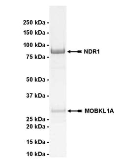 Eurofins DiscoverX NDR1 Protein, Active 250 &mu;g | Buy Online | Eurofins DiscoverX | Fisher Scientific